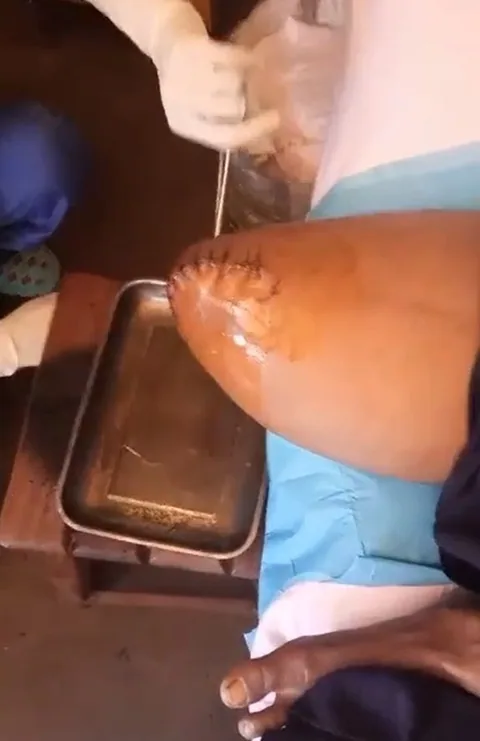SOINS PIVO